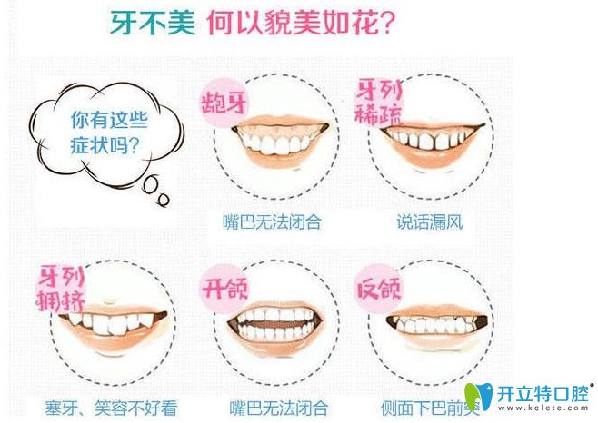 牙齿畸形赶紧趁着活动来铭德做正畸