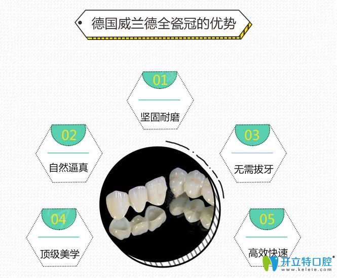 德国威兰德全瓷牙优点