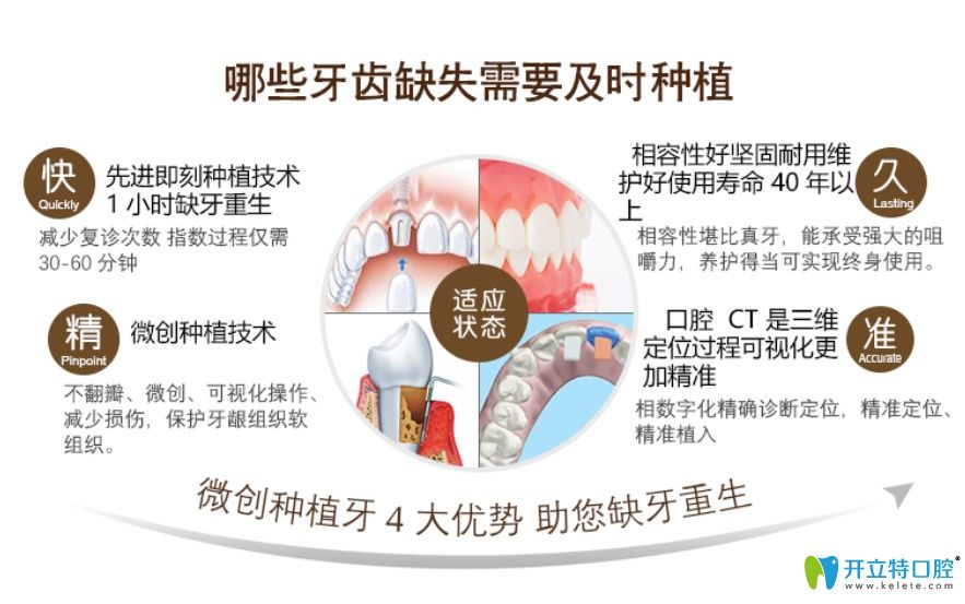 圣贝口腔微创种植牙4大优势介绍