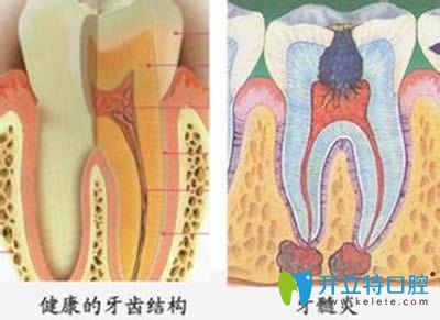张苏娜医生讲解牙体牙髓病的诊断