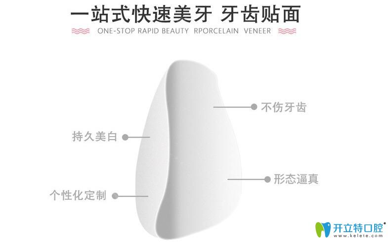 永华口腔牙齿贴面优势介绍 永华口腔牙齿贴面优势介绍