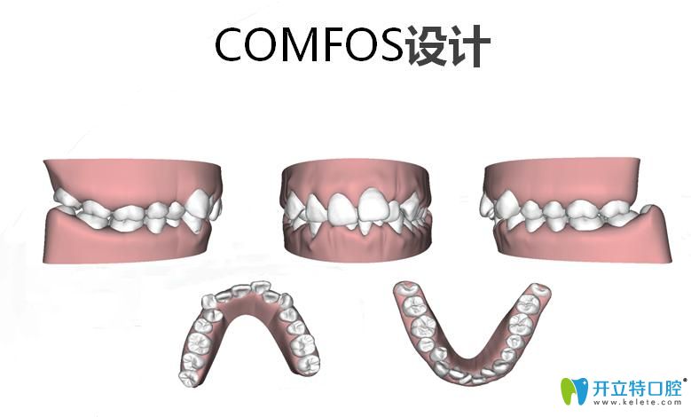comfos设计图示 comfos设计图示