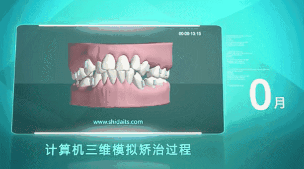 广州致美口腔牙齿矫正设备