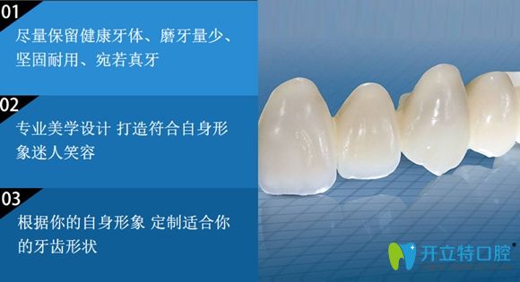上海维乐口腔牙齿修复宣传图