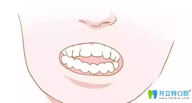 畸形牙齿影响口腔功能