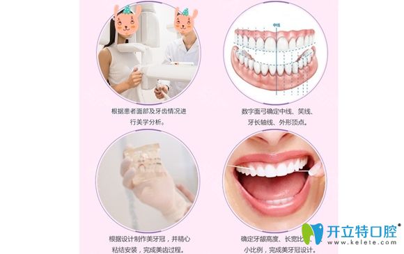 上海圣贝口腔牙齿修复特色图