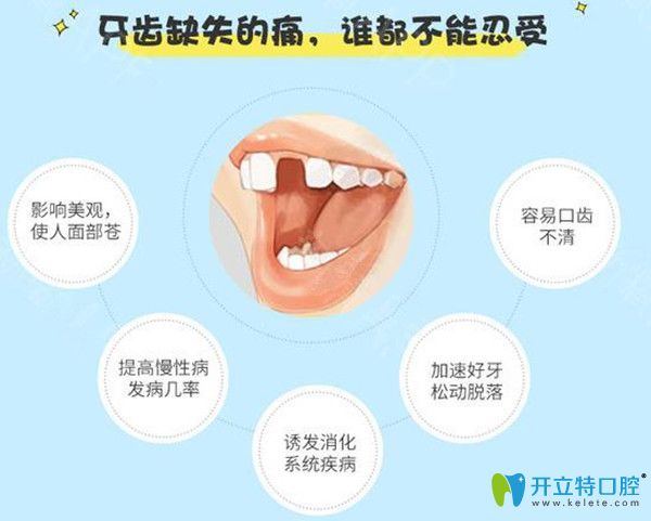 牙齿缺失的坏处