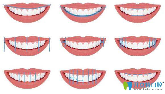泉州美莱口腔美学正畸微笑弧线设计 泉州美莱口腔美学正畸微笑弧线设计