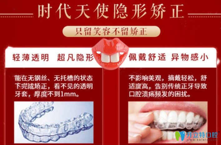宁波艺星口腔时代天使牙套价格 宁波艺星口腔时代天使牙套价格