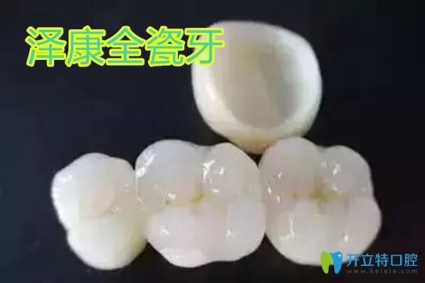 泽康全瓷牙多少钱?价格6000贵吗?威兰德和泽康哪个好了解下