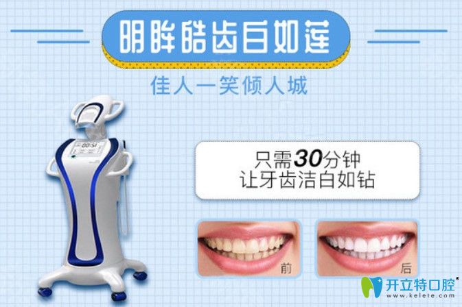 宁波艺星皓齿美白价格 宁波艺星皓齿美白价格