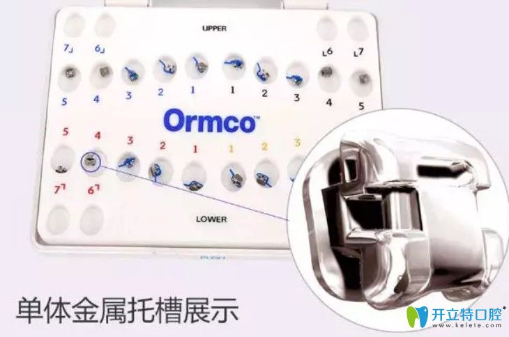 美国ormco（奥美科）自锁托槽矫正器图片