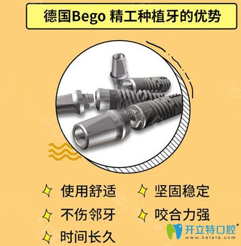 德国Bego种植体 德国Bego种植体