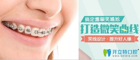 郑州天后口腔在牙齿矫正时更注重微笑线的打造