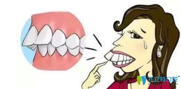 刘医生告诉大家矫正骨性龅牙比较好的时间段