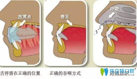 凯思口腔正确的口腔习惯