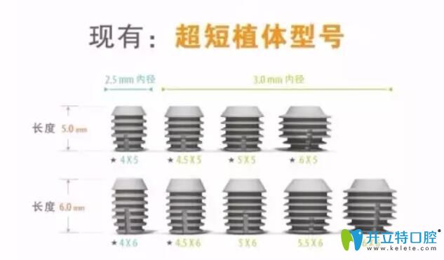 韩国多普勒种植体型号