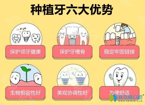 种植牙六大优势
