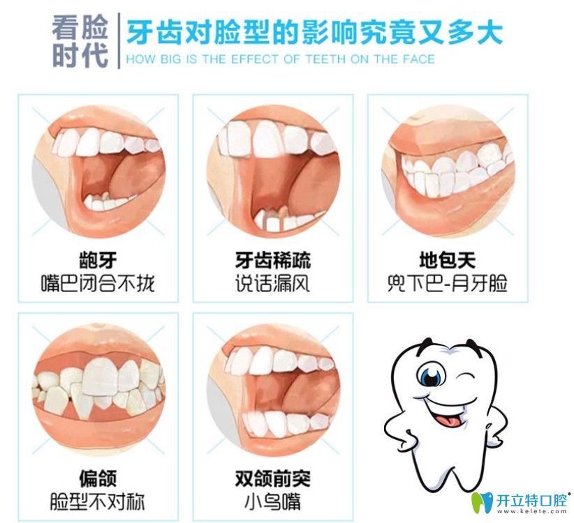 畸形的牙齿对脸型的影响