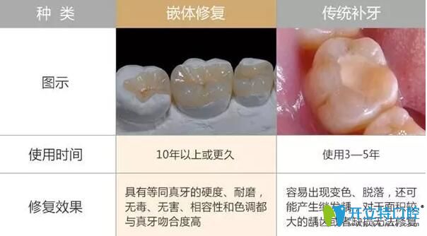 嵌体和补牙的区别
