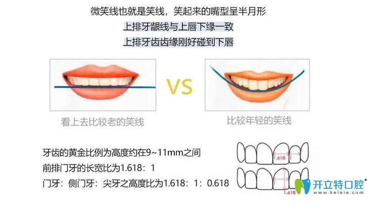 DSD美学微笑曲线设计图