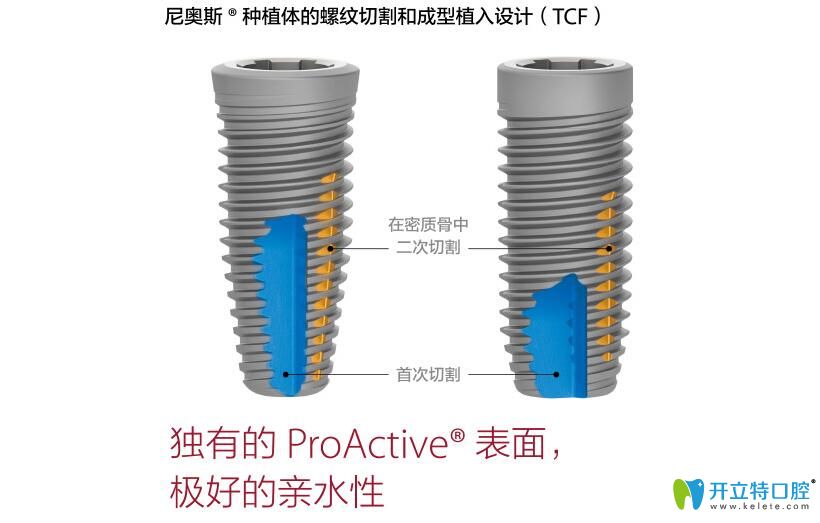 尼奥斯种植体结构图示