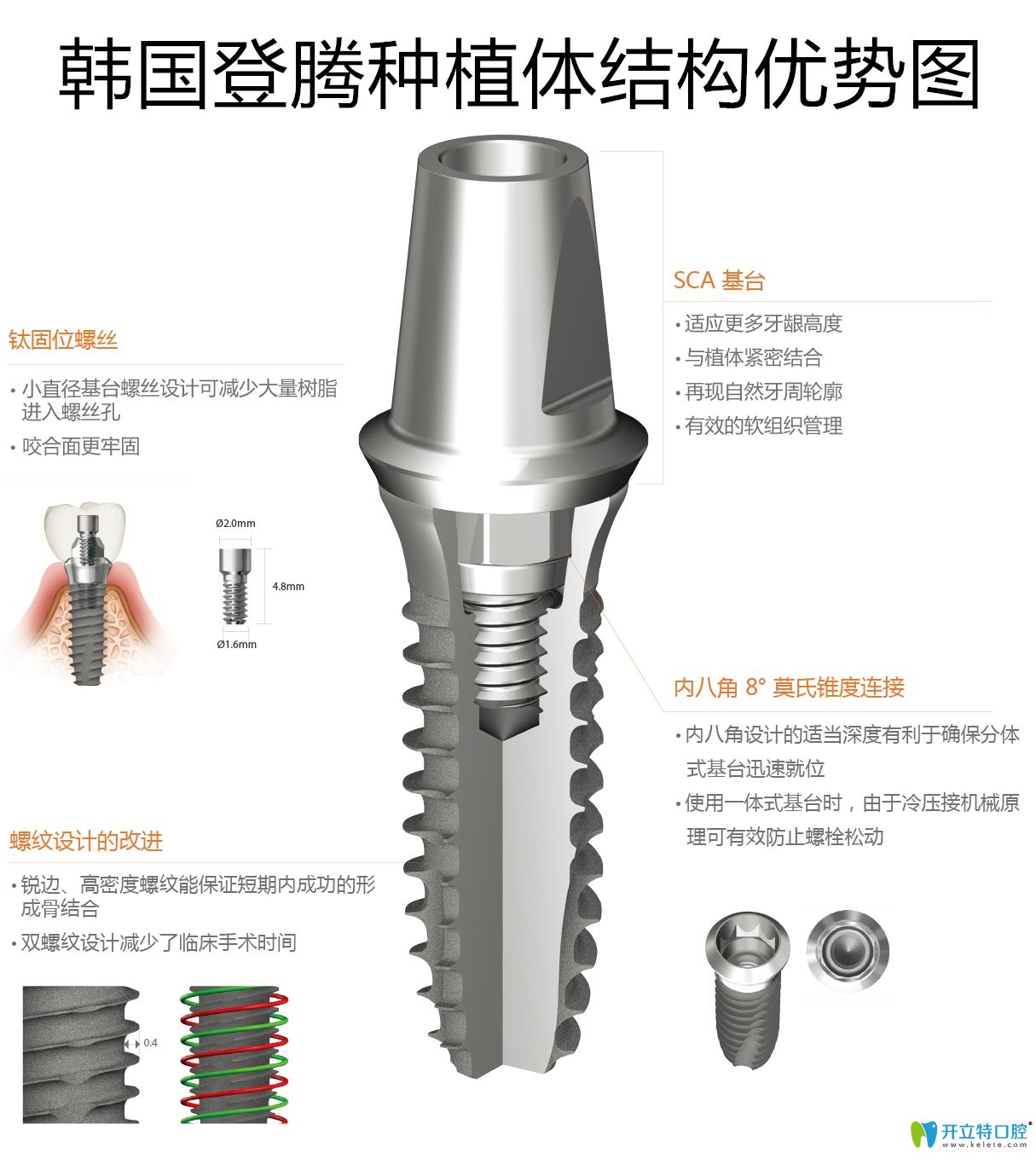 韩国登腾种植体结构优势图