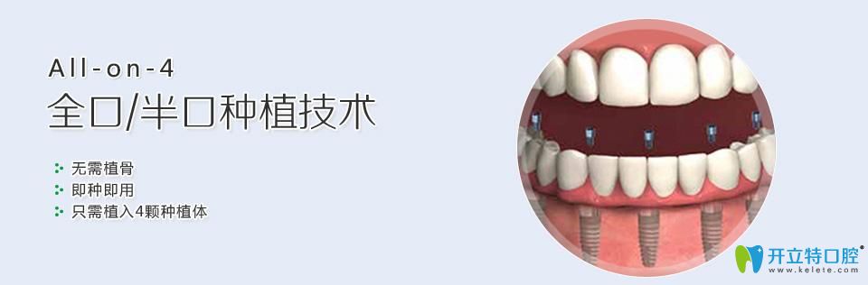 <!--<i data=20240703-sp></i>-->口腔特色种植技术