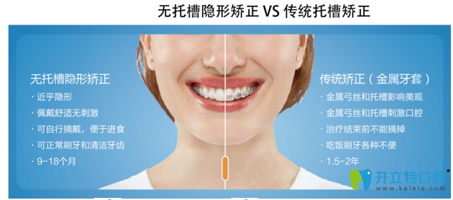 隐形矫正和传统矫正 隐形矫正和传统矫正