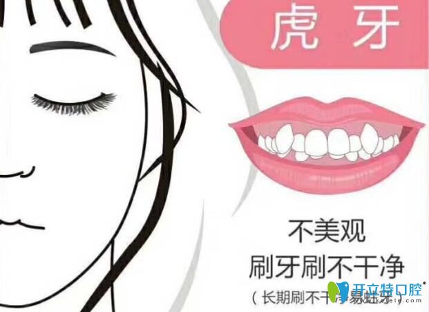 重庆维乐口腔陈瑶做牙齿矫正好不好