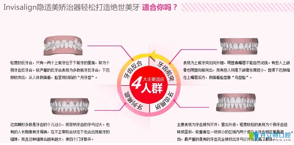 隐适美隐形矫正适应人群