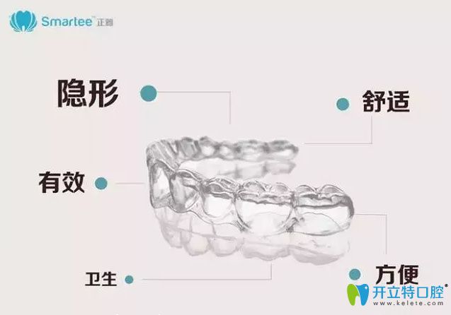 正雅隐形矫正牙套优点