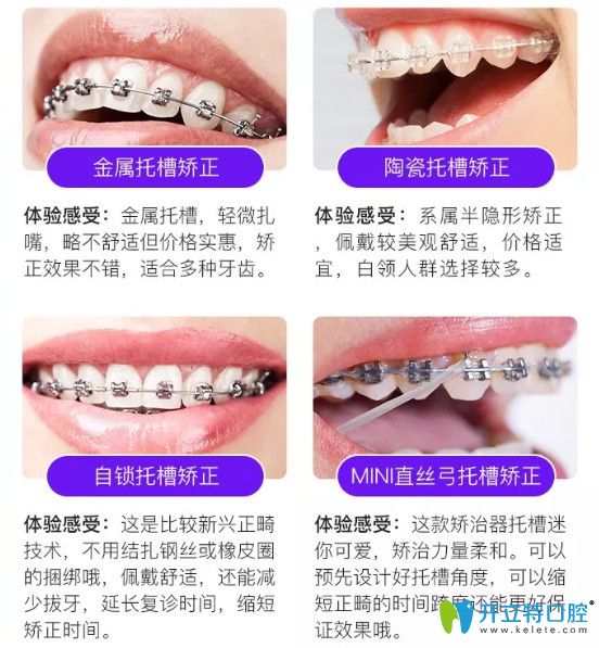 上海永华口腔牙齿矫正项目