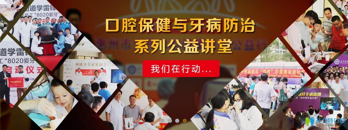 惠州致美口腔公益活动