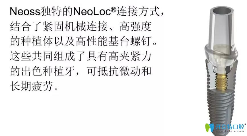 瑞典Neoss种植体优势