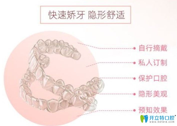 时代天使隐形矫正价格 时代天使隐形矫正价格