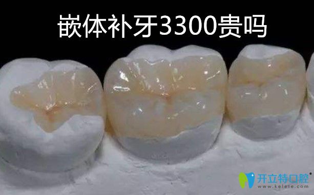 补牙！补牙！关于嵌体补牙3300贵不贵专业机构给出了答案