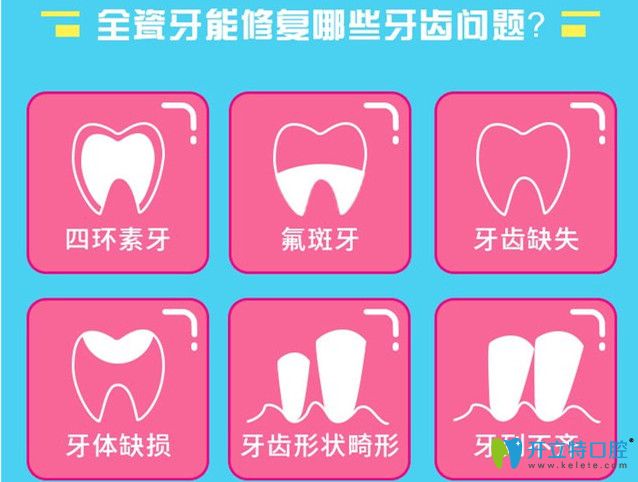 全瓷牙能够修复的牙齿问题