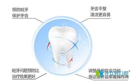 为什么要做窝沟封闭