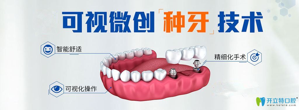 可视微创数字化种牙技术