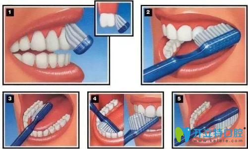 正确的刷牙方法