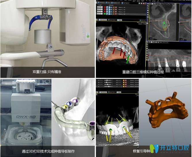 数字化种植过程