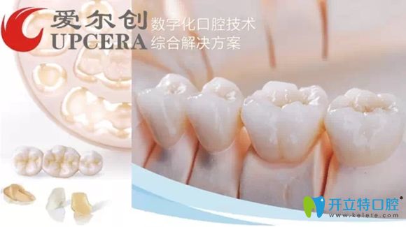后磨牙做完根管治疗后医生推荐戴爱尔创瓷倍健全瓷牙套