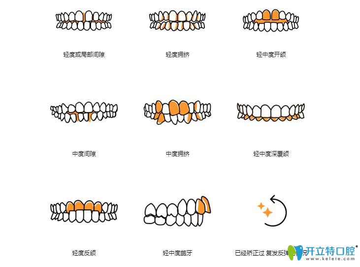 easysmile矫正适合类型