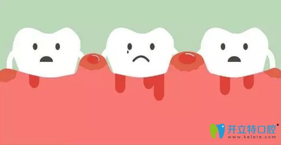 牙周炎不治疗会引起牙齿过早脱落