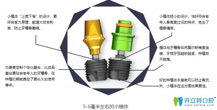 小植体亲骨种植牙的优势有哪些 小植体亲骨种植牙的优势有哪些