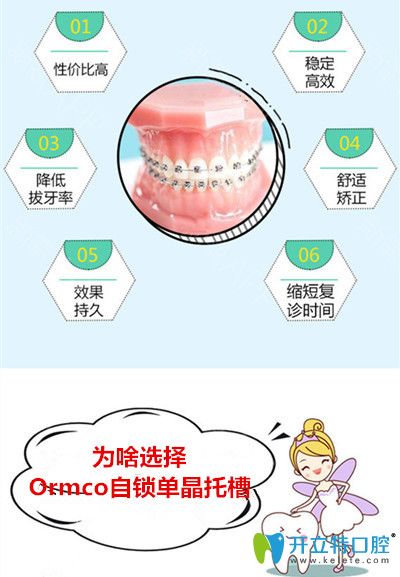 Ormco自锁单晶托槽矫正的优势