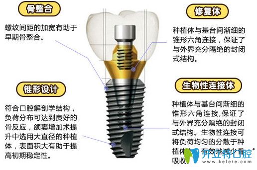 傅氏韩国登腾种植体