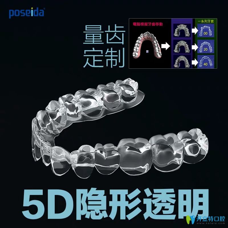 poseida博世达5D隐形牙套矫正牙齿效果怎么样?这些内幕要知道