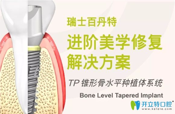 认真看完这篇介绍,你对瑞士百丹特种植体就不觉得陌生了